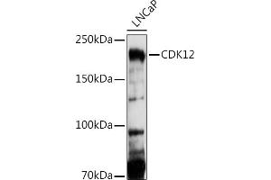 Western blot analysis of extracts of LNCaP cells, using CDK12 antibody (ABIN7266230) at 1:1000 dilution. (CDK12 Antikörper  (AA 80-290))