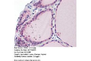 Immunohistochemistry with Human Thyroid lysate tissue at an antibody concentration of 5. (LDOC1 Antikörper  (N-Term))
