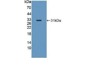 Detection of Recombinant b4GALNT2, Human using Polyclonal Antibody to Beta-1,4-N-Acetyl Galactosaminyl Transferase 2 (b4GALNT2) (B4GALNT2 Antikörper  (AA 324-566))