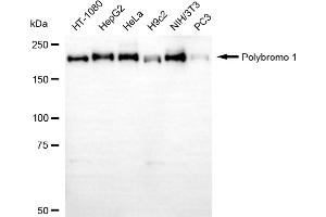 Western blotting analysis using polybromo 1 antibody (ABIN7799873).