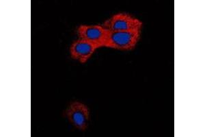 Immunofluorescence (IF) image for anti-Transforming Growth Factor, beta 1 (TGFB1) (C-Term) antibody (ABIN7297124)