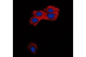 Immunofluorescent analysis of TGF beta 1 staining in MCF7 cells. (TGFB1 Antikörper  (C-Term))