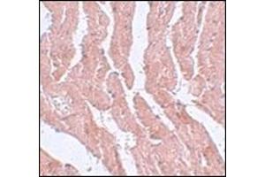 Immunohistochemistry of LZTR1 in mouse heart tissue with this product at 5 μg/ml. (LZTR1 Antikörper  (N-Term))