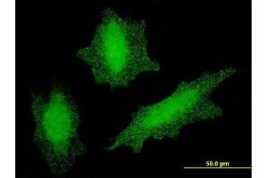 Immunofluorescence of monoclonal antibody to VHL on HeLa cell. (VHL Antikörper  (AA 1-110))