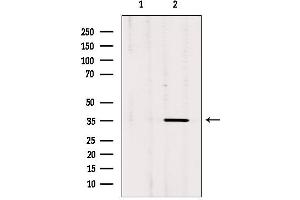 Western blot analysis of extracts from rat brain, using OR3A1 Antibody. (OR3A1 Antikörper)