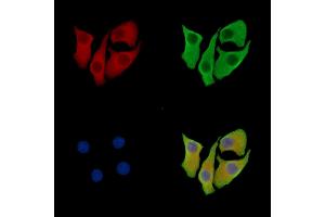 LZTS3 Antibody staining Hela cells by IF/ICC. (ProSAPiP1 Antikörper)
