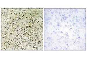Immunohistochemistry (IHC) image for anti-Deleted in Liver Cancer 1 (DLC1) (N-Term) antibody (ABIN1849916) (DLC1 Antikörper  (N-Term))
