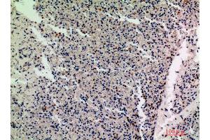 Immunohistochemistry (IHC) analysis of paraffin-embedded Human Spleen, antibody was diluted at 1:200. (IL1F10 Antikörper)