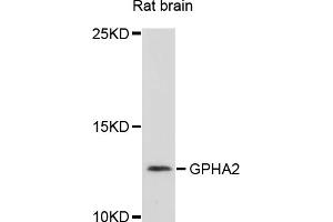 Western blot analysis of extracts of rat brain, using GPHA2 antibody (ABIN4903807) at 1:1000 dilution. (GPHa2 Antikörper)