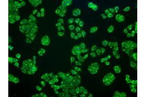 Image no. 5 for anti-Crystallin, alpha B (CRYAB) antibody (ABIN1497644) (CRYAB Antikörper)