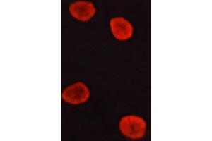 ABIN6266535 staining lovo cells by ICC/IF. (ERK1/2 Antikörper)