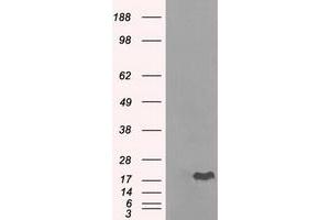 Image no. 8 for anti-Crystallin, alpha B (CRYAB) antibody (ABIN1497645) (CRYAB Antikörper)