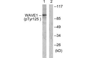 Western Blotting (WB) image for anti-WAS Protein Family, Member 1 (WASF1) (pTyr125) antibody (ABIN1847304) (WASF1 Antikörper  (pTyr125))