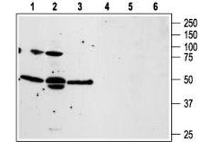 Western blot analysis of human prostate carcinoma PC3 (lanes 1 and 4), and LNCaP (lanes 2 and 5), and human T cell leukemia Jurkat (lanes 3 and 6) cell lines: - 1-3. (F2RL3 Antikörper  (1st Extracellular Loop))