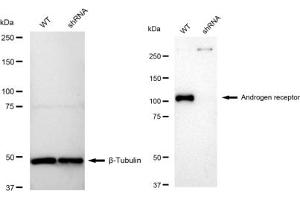 Western blotting analysis using Androgen Receptor antibody (ABIN7797600).