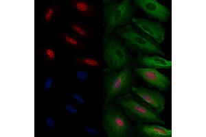 ABIN6263185 and ABIN6272471 staining  cells by IF/ICC. (MECP2 Antikörper  (N-Term))