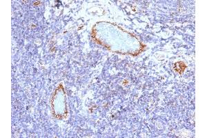 Formalin-fixed, paraffin-embedded human Tonsil stained with vWF Mouse Monoclonal Antibody (VWF/1465).
