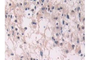 Immunohistochemistry (IHC) image for anti-Endoglin (ENG) (AA 26-136) antibody (ABIN7438025)