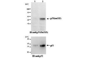 Western Blotting (WB) image for anti-Tumor Protein P53 (TP53) (pSer315) antibody (ABIN1449252) (p53 Antikörper  (pSer315))