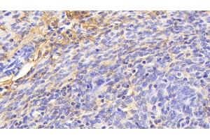 Immunohistochemistry (IHC) image for anti-Procollagen III N-Terminal Propeptide (PIIINP) (AA 24-154) antibody (ABIN7445201)