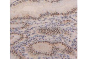 Used in DAB staining on fromalin fixed paraffin- embedded Kidney tissue (MBD2 Antikörper  (AA 145-411))