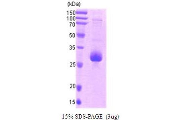 Survivin Protein (AA 1-142) (Calmodulin (CaM))