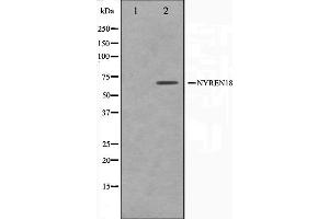 Western blot analysis on COS7 cell lysate using NYREN18 Antibody,The lane on the left is treated with the antigen-specific peptide.
