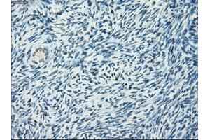 Immunohistochemical staining of paraffin-embedded colon tissue using anti-PORmouse monoclonal antibody. (POR Antikörper)