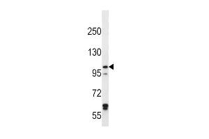 IREB2 Antibody (Center) (ABIN656586 and ABIN2845848) western blot analysis in Hela cell line lysates (35 μg/lane). (IREB2 Antikörper  (AA 201-230))