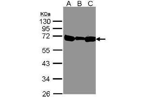 WB Image Sample(30 μg of whole cell lysate) A:293T B:A431, C:H1299 12% SDS PAGE antibody diluted at 1:500