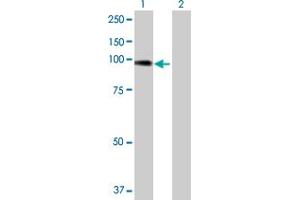 Western Blot analysis of ACTN4 expression in transfected 293T cell line by ACTN4 MaxPab polyclonal antibody. (alpha Actinin 4 Antikörper  (AA 1-911))