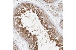 Immunohistochemical staining (Formalin-fixed paraffin-embedded sections) of human testis with CRAT polyclonal antibody  shows strong cytoplasmic positivity in cells in seminiferous ducts. (CRAT Antikörper)