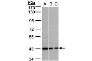 WB Image Sample (30μg whole cell lysate) A:A431, B:MOLT4 , C:Raji , 7. (G Protein alpha Inhibitor 3 (Center) Antikörper)