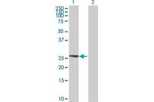 Western Blot analysis of PTTG2 expression in transfected 293T cell line ( H00010744-T01 ) by PTTG2 MaxPab polyclonal antibody. (PTTG2 Antikörper  (AA 1-191))