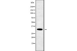 Western blot analysis OR10W1 using 293 whole cell lysates (OR10W1 Antikörper  (Internal Region))