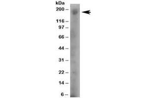 Western blot testing of human A431 lysate with DOCK1 antibody at 4ug/ml. (DOCK1 Antikörper)