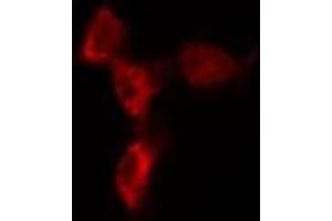 ABIN6274621 staining 293T by IF/ICC. (COL1A2 Antikörper  (N-Term))