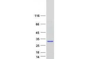 Western Blotting (WB) image for RWD Domain Containing 3 (RWDD3) (Transcript Variant 2) protein (Myc-DYKDDDDK Tag) (ABIN2731268)