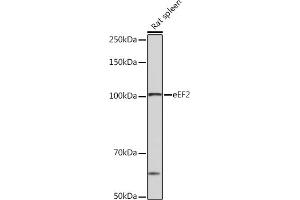 Western blot analysis of extracts of Rat spleen, using eEF2 Rabbit mAb (ABIN7267025) at 1:1000 dilution. (EEF2 Antikörper)
