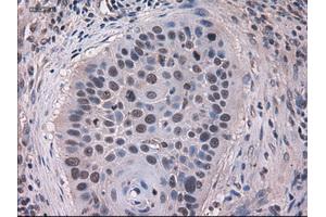 Immunohistochemical staining of paraffin-embedded kidney using anti-KRT18 (ABIN2452674) mouse monoclonal antibody. (Cytokeratin 18 Antikörper  (AA 69-372))