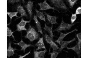 Immunofluorescent staining of HeLa cells (ATCC CCL-2). (MEK1 Antikörper)