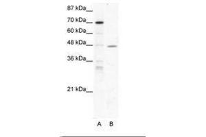 Image no. 1 for anti-Nuclear Receptor Subfamily 2, Group F, Member 6 (NR2F6) (AA 264-313) antibody (ABIN202436) (NR2F6 Antikörper  (AA 264-313))