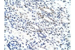 NOL4 antibody was used for immunohistochemistry at a concentration of 4-8 ug/ml to stain Epithelial cells of renal tubule (arrows) in Human Kidney. (NOL4 Antikörper  (N-Term))