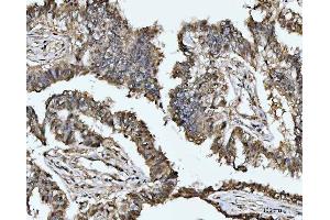 IHC analysis of MAT2A using anti-MAT2A antibody (ABIN7599120). (MAT2A Antikörper  (AA 1-229))
