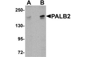 Western Blotting (WB) image for anti-Partner and Localizer of BRCA2 (PALB2) (C-Term) antibody (ABIN1030568) (PALB2 Antikörper  (C-Term))