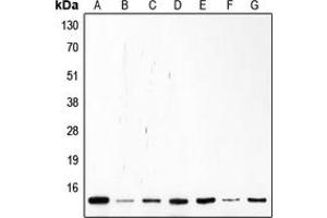 Western blot analysis of p14 ARF expression in Saos2 (A), Molt (B), K562 (C), Jurkat (D), HL60 (E), MCF7 (F), HeLa (G) whole cell lysates.