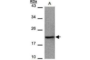 WB Image Sample(30 μg of whole cell lysate) A:293T 15% SDS PAGE antibody diluted at 1:1000 (Survivin Antikörper)