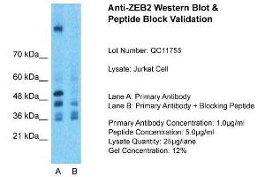 Host:  Rabbit  Target Name:  ZEB2  Sample Type:  Jurkat Whole Cell  Lane A:  Primary Antibody  Lane B:  Primary Antibody + Blocking Peptide  Primary Antibody Concentration:  1ug/ml  Peptide Concentration:  5ug/ml  Lysate Quantity:  25ug/lane/Lane  Gel Concentration:  0.