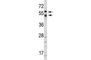 Western blot analysis of CA9 antibody and HepG2 lysate. (CA9 Antikörper  (AA 63-90))