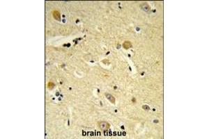 Formalin-fixed and paraffin-embedded human brain tissue reacted with CDIPT Antibody (Center), which was peroxidase-conjugated to the secondary antibody, followed by DAB staining. (CDIPT Antikörper  (AA 99-125))